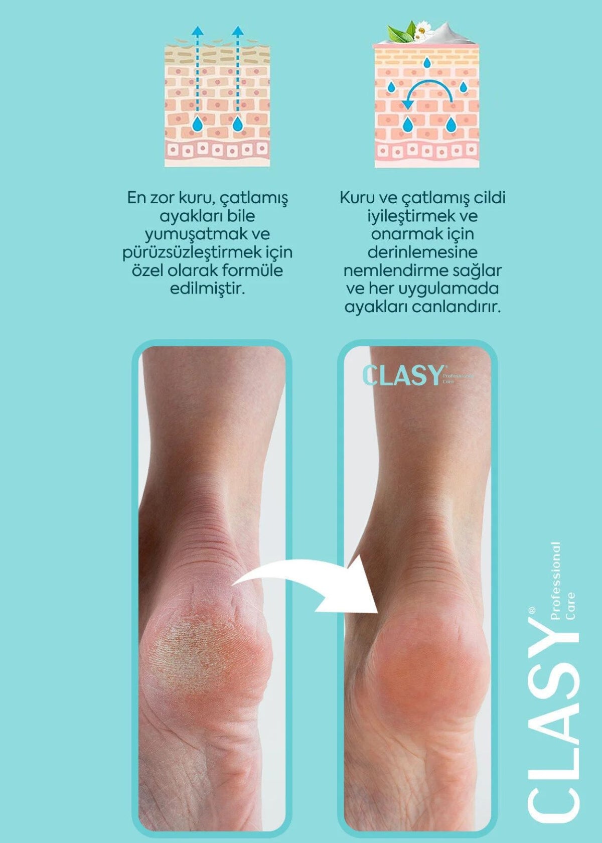 CLASY Crack Repair Cream – Fuß- und Fersenpflege