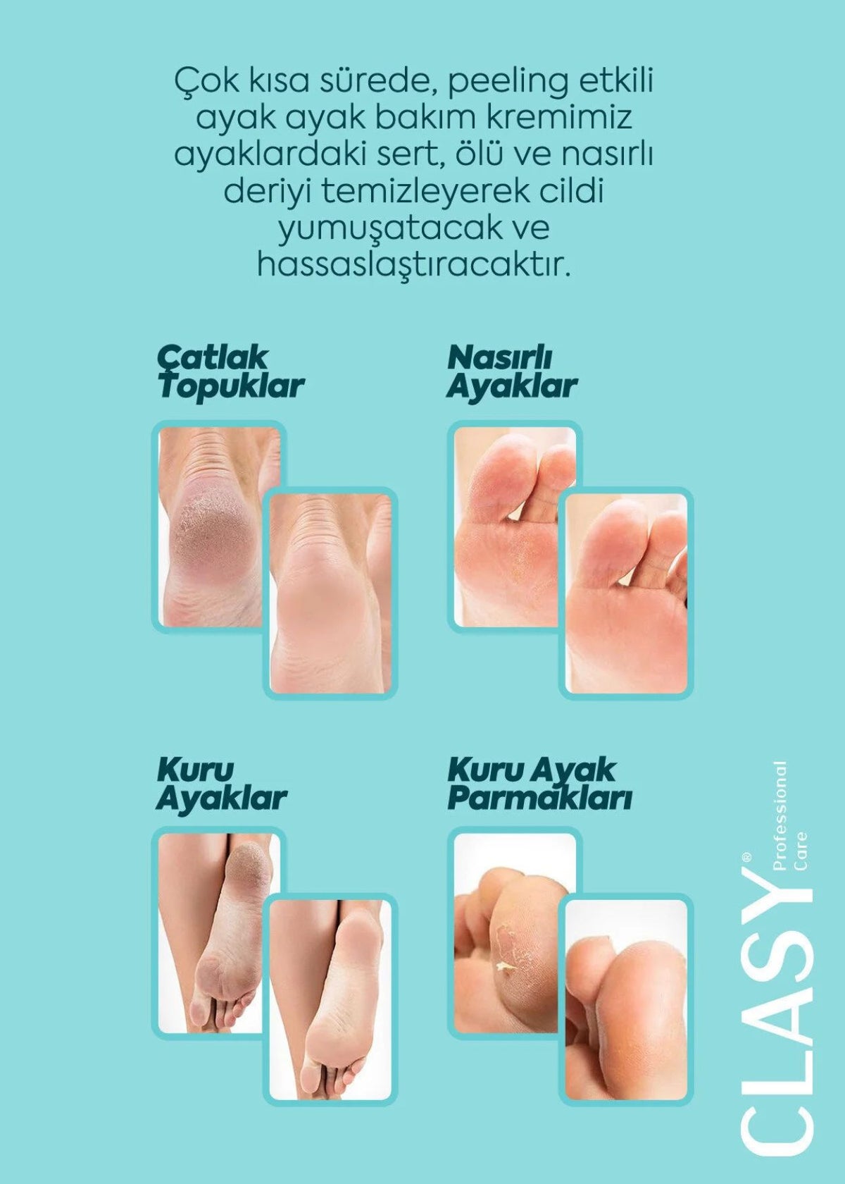 CLASY Crack Repair Cream – Fuß- und Fersenpflege